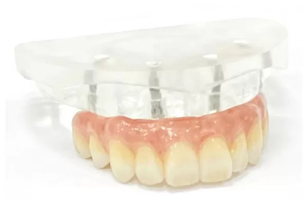 最終補綴物の作製