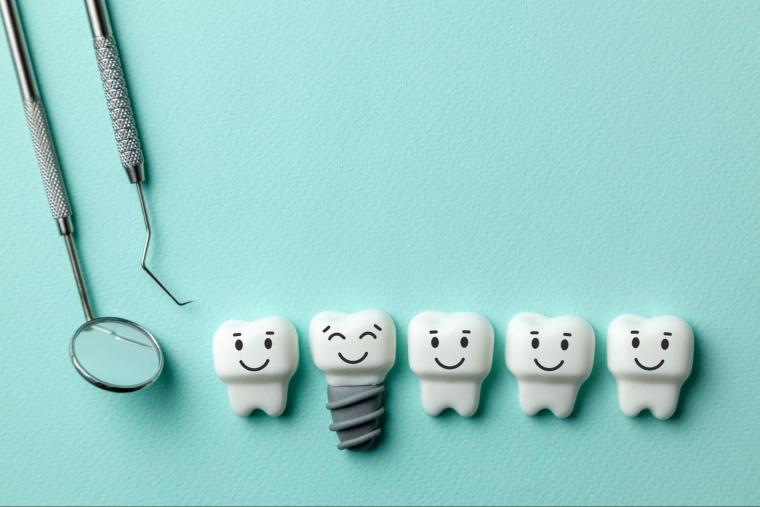 インプラントと差し歯の違いを徹底解説！自分に合った治療法はどっち？