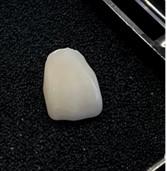 セラミック・ジルコニアってよく聞くけどどんな素材？