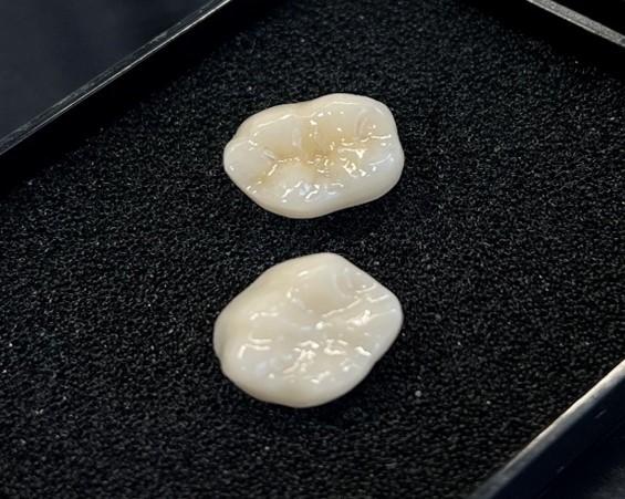 セラミック・ジルコニアってよく聞くけどどんな素材？