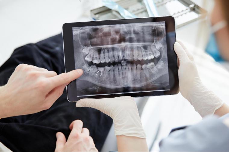 オールオン4は保険適用できる？費用負担を軽くする方法を解説