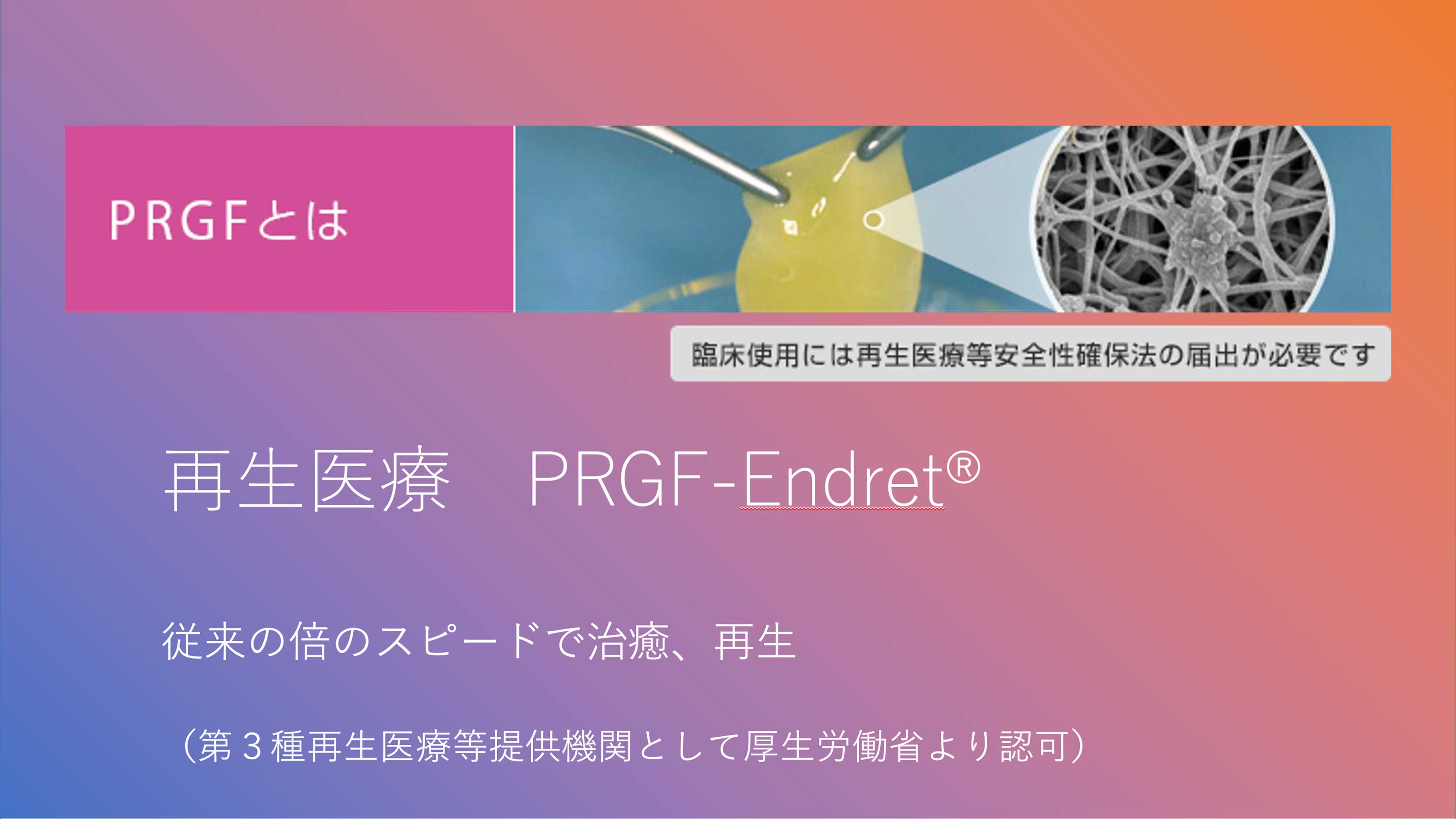 再生医療PRGFとは